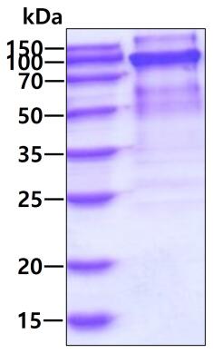 3ug by SDS-PAGE under reducing condition and visualized by coomassie blue stain.